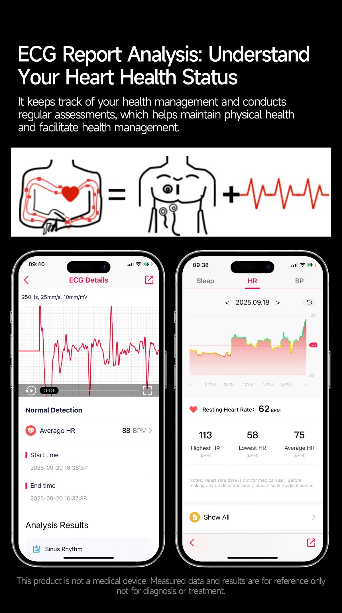 2026 New Accurate Diagnosis ECG Smart Watch Body Fat Blood oxygen BP Health Sport HD AMOLED Screen call Smart watch Men Women