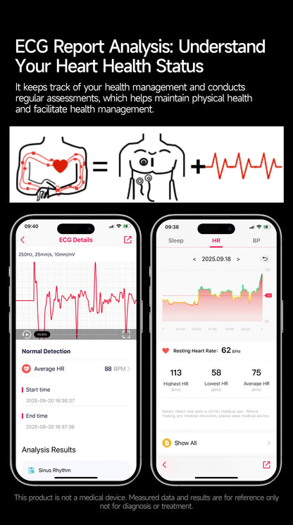 2026 New AI-Diagnosis Care Smartwatch ECG+PPG Accurate Uric Acid Blood Pressure Body Fat Five Organ Fitness Waterproof Smartwatc