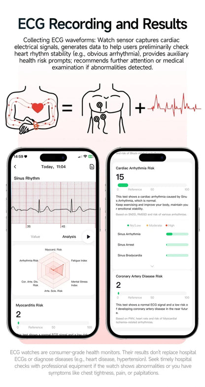 2026 New Professional-Grade Health Smart Watch Men ECG BP HR Uric Acid Lipid BMI Body Analysis Bluetooth Call Smartwatch Women